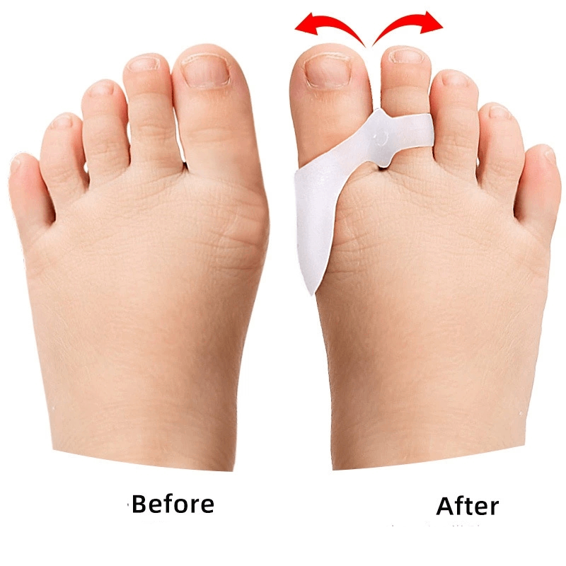 1/2/3 pares crianças gel toe s - Toe Separator Silicon avaliação e preço