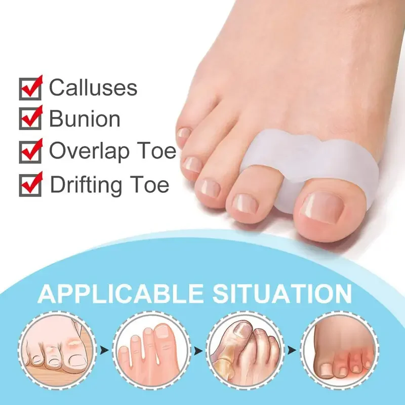 Corretor de joanete 1 par – Se - Toe Separator Silicon avaliação e preço